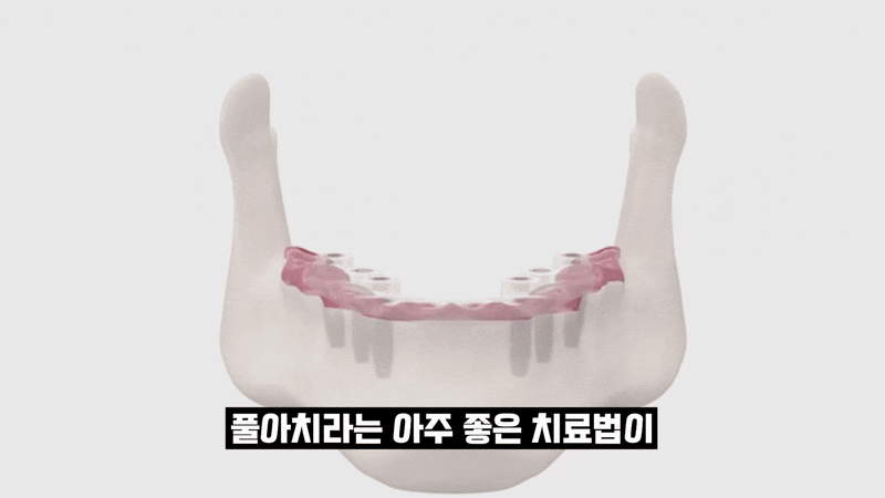 비타민D 치아건강 도움되는 이유 관련 이미지 7