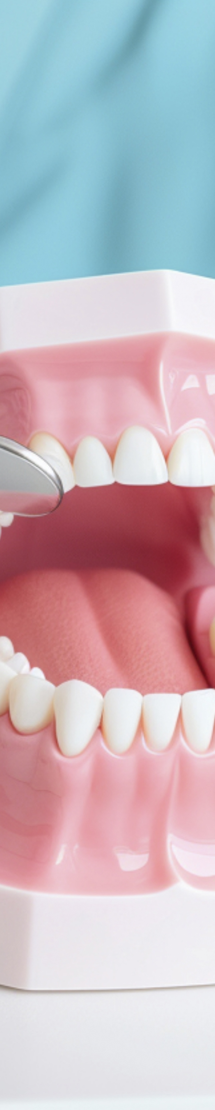 라미네이트 빠짐 이런 경우에 어떻게 해야 할까 관련 이미지 25