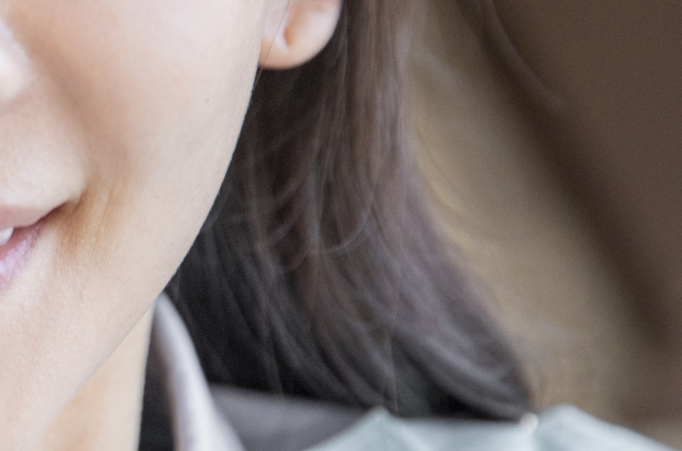 강남 20대임플란트 젊다고 방치는 금지 관련 이미지 14