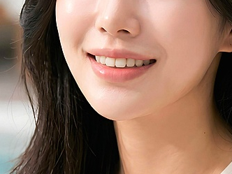 청담 앞니 라미네이트 가격 싸다고 덥석 정하면 후회합니다 관련 이미지 11