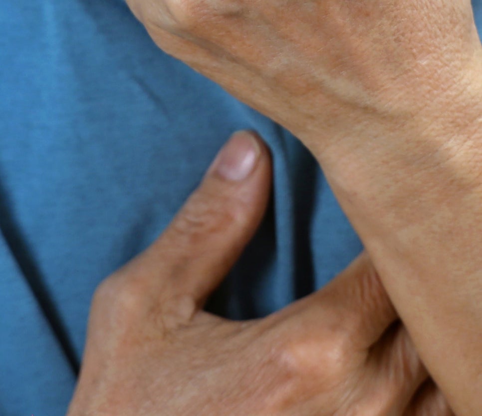 역류성식도염 목이물감 가래 낀 느낌이 느껴지나요? 관련 이미지 23