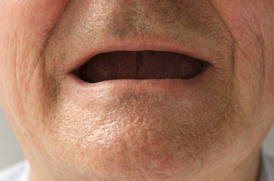 강남구청치과 틀니와는 다른 차원의 편안함 관련 이미지 7