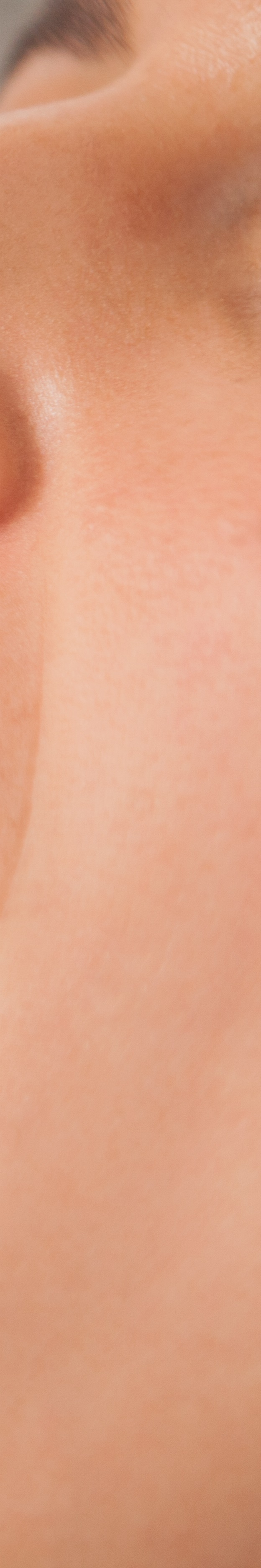 최소 삭제 라미네이트 치아를 지키며 아름다움 더하기 관련 이미지 31