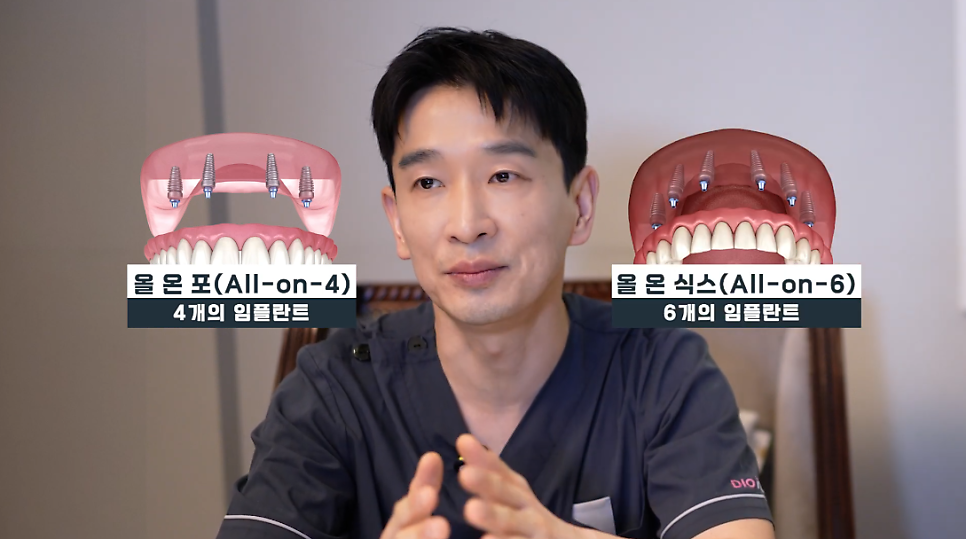 올온엑스 비용 합리적으로 접근하는 방법 관련 이미지 4