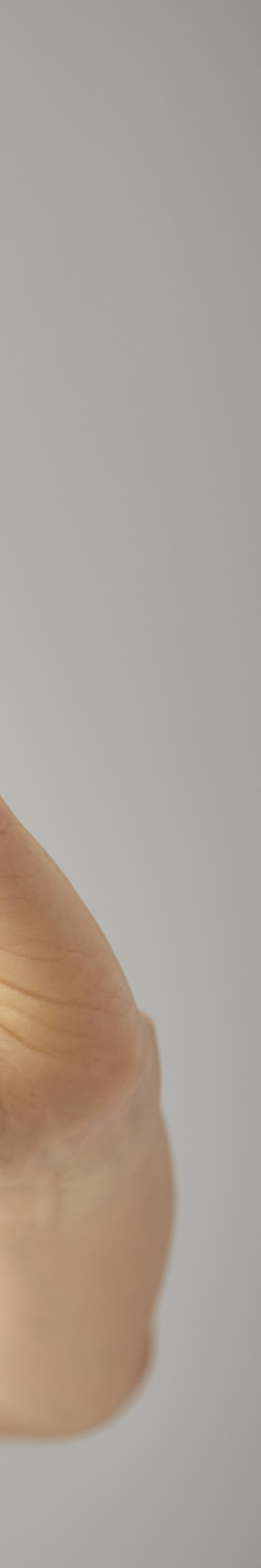 임플란트 임시틀니 빠졌을 때 당황하지 말고 이것부터 관련 이미지 27