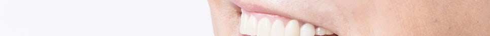 If You’re Considering Full-Arch Implant Dentures image 35