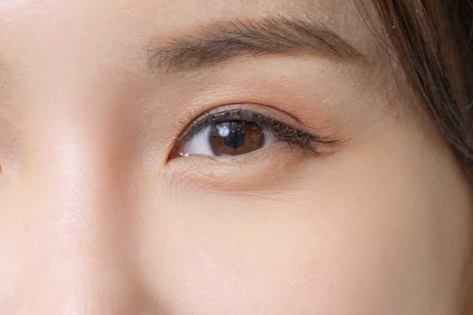 학동사거리치과 무치악 어르신들이라면? 관련 이미지 19