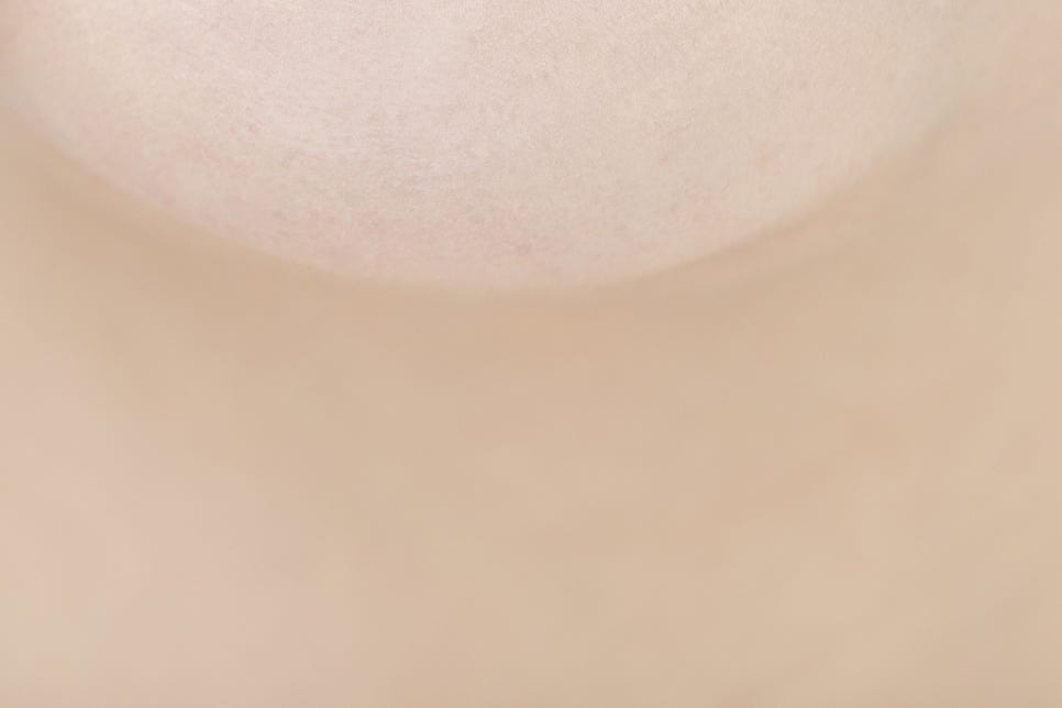 학동사거리 치과 무치악 임플란트 고민이라면 관련 이미지 25