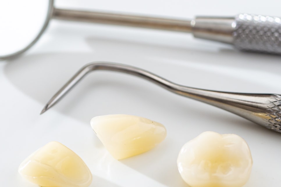 청담역 임플란트 치아 상실 극복을 바라며 관련 이미지 13