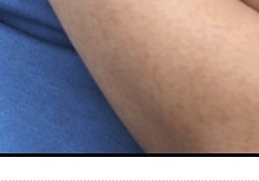 슬픈젖꼭지 증후군 진짜 있을까요? 관련 이미지 14