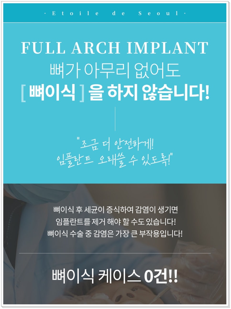 신사동 앞니 라미네이트 가격 비교해야 하는 이유 관련 이미지 8