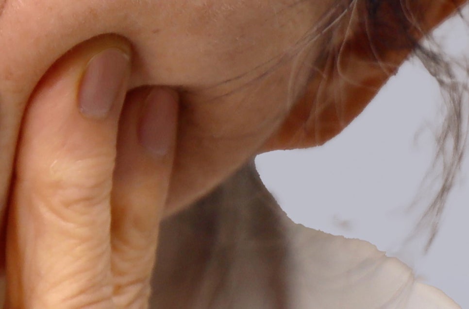 강남 어금니 임플란트 고려가 필요한 4가지! 관련 이미지 23