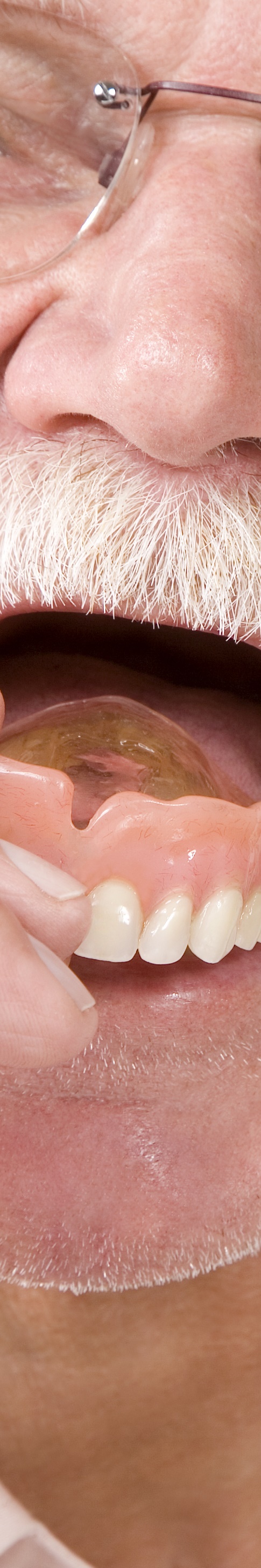 임플란트임시틀니 착용 기간과 교체 시기 관련 이미지 27