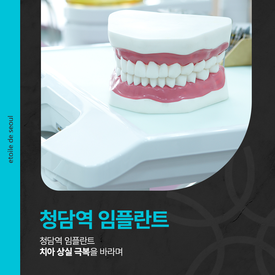 청담역 임플란트 치아 상실 극복을 바라며 관련 이미지 1