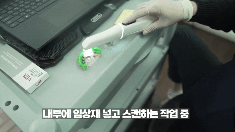 지르코니아임플란트가격 특징과 장점 관련 이미지 4