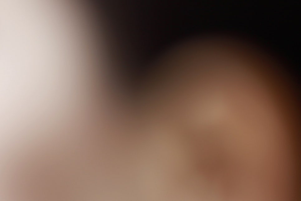 풀아치임플란트 비용 주의사항도 익혀보기 관련 이미지 23