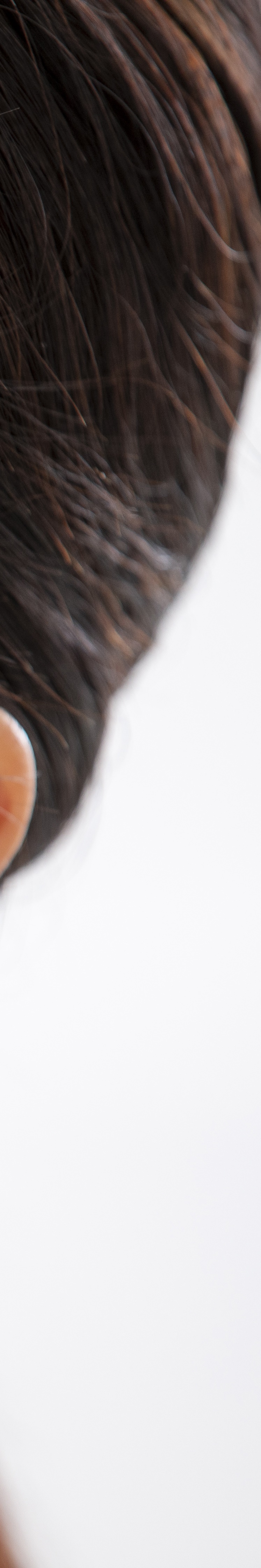 전체임플란트잘하는곳 치아 고민 끝에 만난 새로운 시작 관련 이미지 21