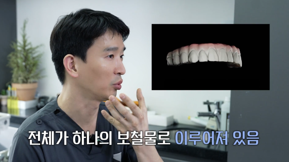 풀아치임플란트단점 알아보고 결정하자 관련 이미지 5