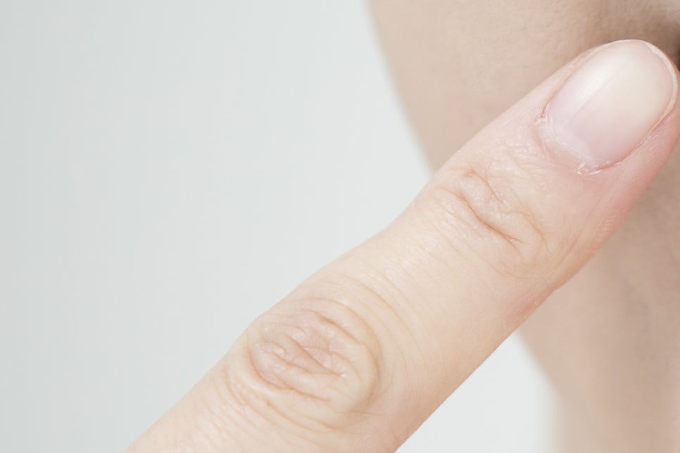 학동사거리 치과 무치악 임플란트 고민이라면 관련 이미지 21