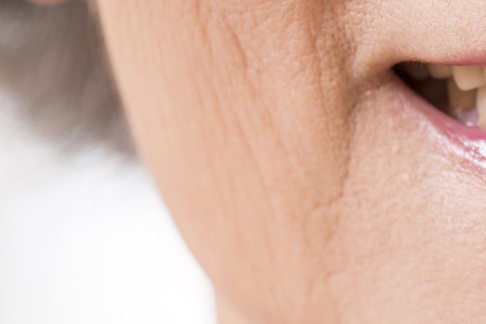 강남 65세이상임플란트 이것만 참고하자! 관련 이미지 12