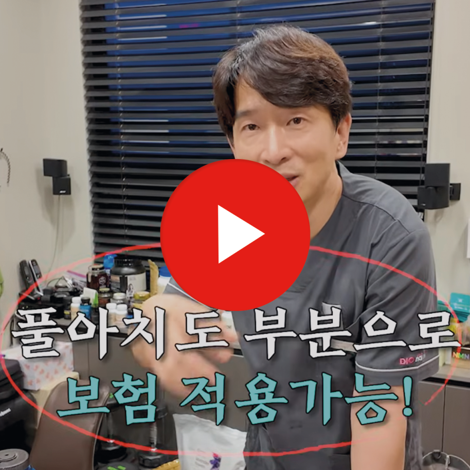 풀아치 임플란트 가격 틀니와 다른 점 관련 이미지 2