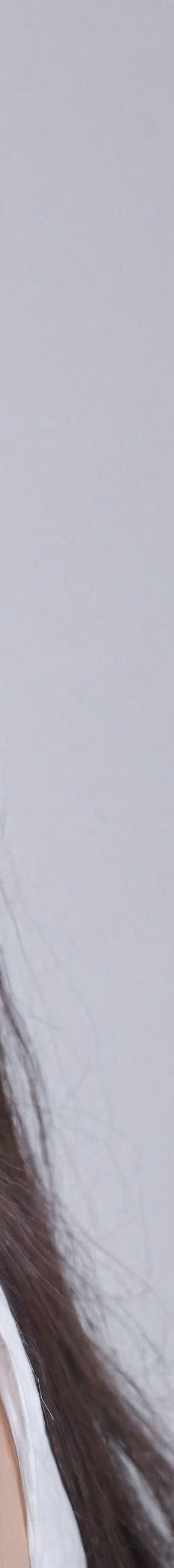 앞니올세라믹 숨겨왔던 미소를 되찾다 관련 이미지 30