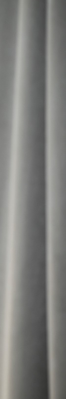 전체임플란트 임시치아 자연스러운 곳 관련 이미지 39