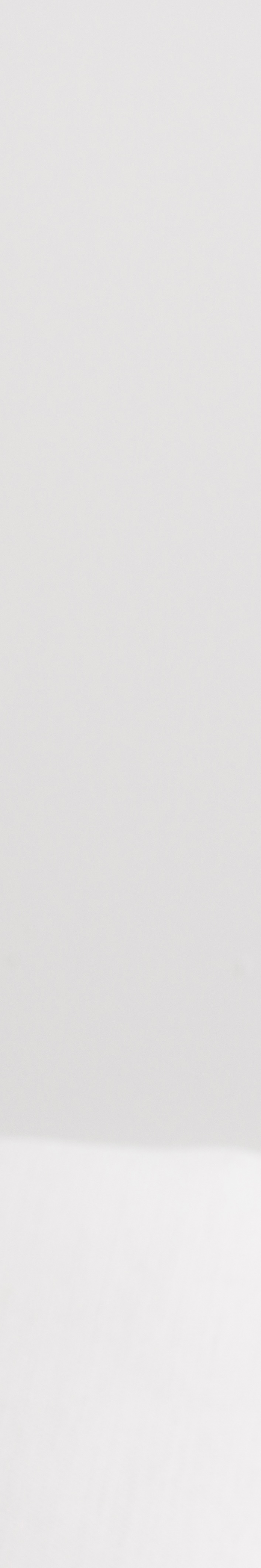 서울무삭제라미네이트 치아 본연의 아름다움을 지키다 관련 이미지 29