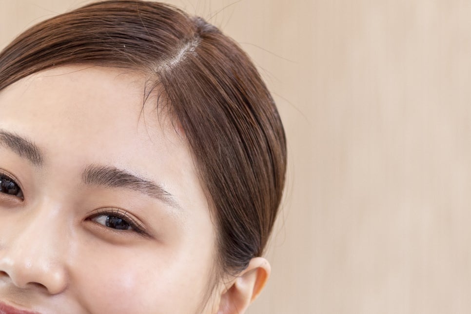 강남 풀아치임플란트 아리따운 미소를 되찾아 관련 이미지 10