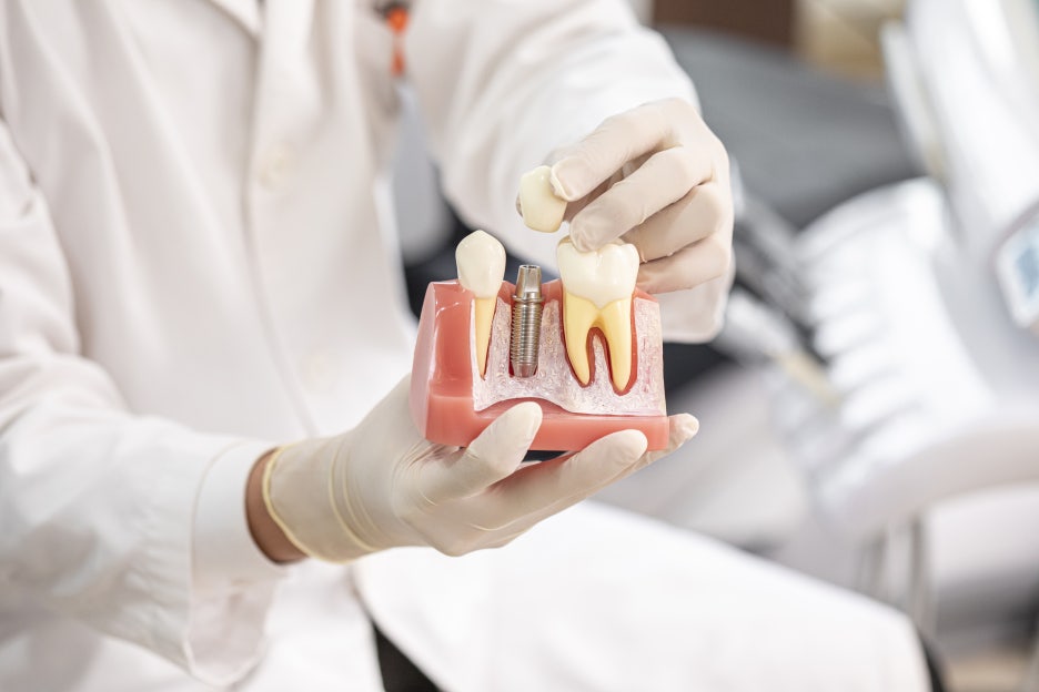 선릉 풀아치임플란트 기간 동안 일상생활 가능할까 관련 이미지 3