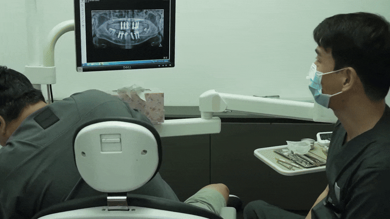 강남 풀아치임플란트 가격 저렴하면서 실력 좋은 곳 찾는 법 관련 이미지 6