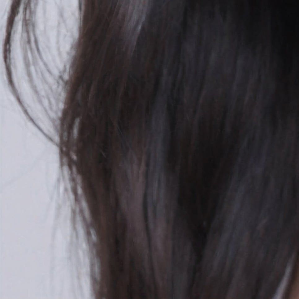 압구정로데오치과 추천 밝아지는 인상으로 관련 이미지 15