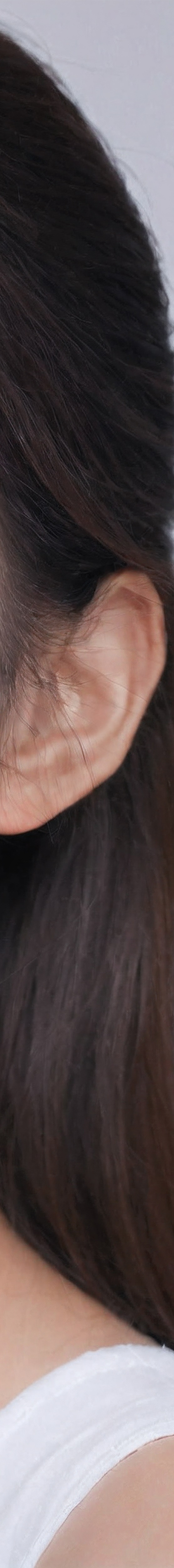 압구정라미네이트 인상을 바꾸는 방법 관련 이미지 21