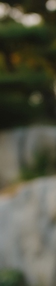 압구정치과 전악 임플란트 가격 비교와 진행 과정 관련 이미지 25