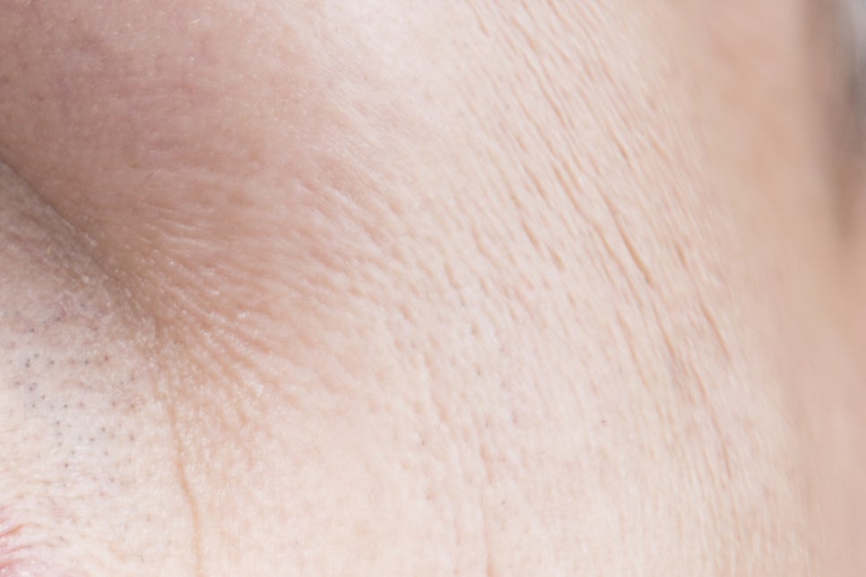 청담동 임플란트 불편함을 줄인 방법 관련 이미지 20