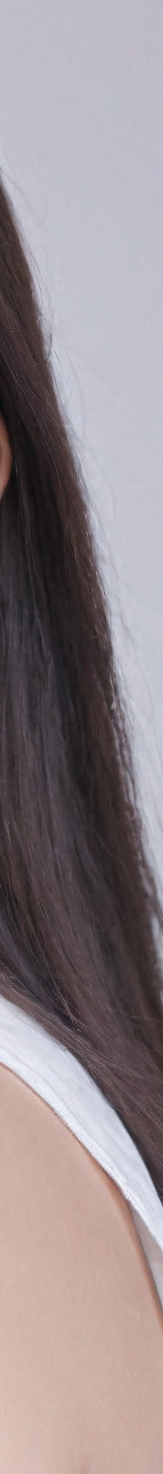 앞니올세라믹 숨겨왔던 미소를 되찾다 관련 이미지 29