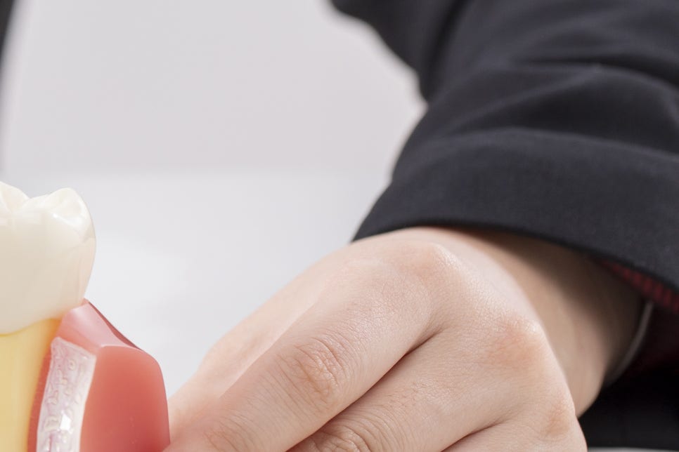 청담 임플란트 치과 미룰수록 독이에요! 관련 이미지 14