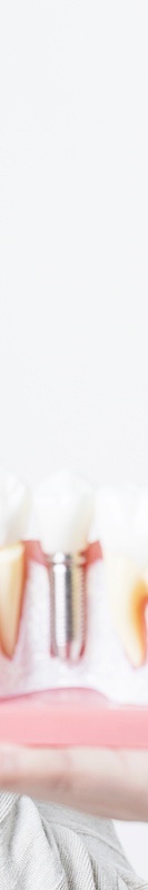 압구정 부분임플란트 가격 비교를 위해 관련 이미지 37