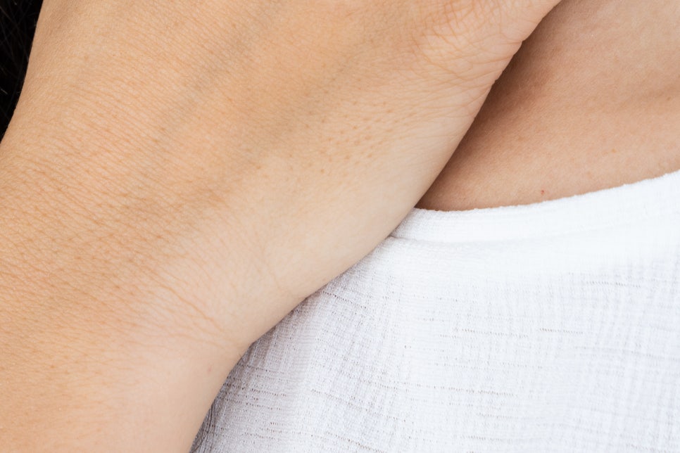 역류성식도염 목이물감 가래 낀 느낌이 느껴지나요? 관련 이미지 14