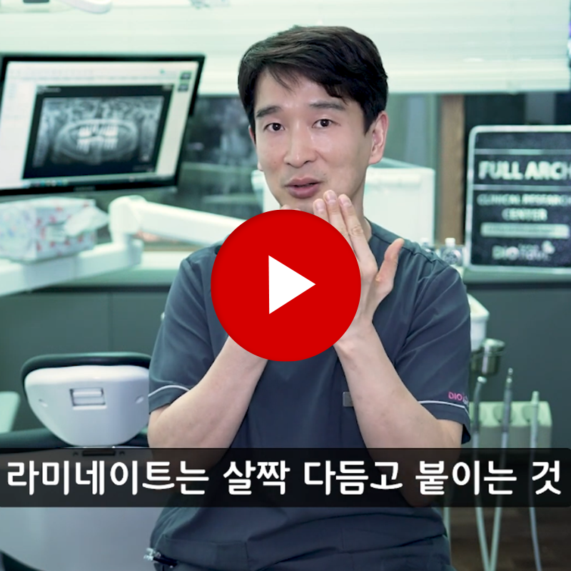 압구정 치아 깎지 않는 라미네이트 오래 못 간다는 걱정 관련 이미지 2