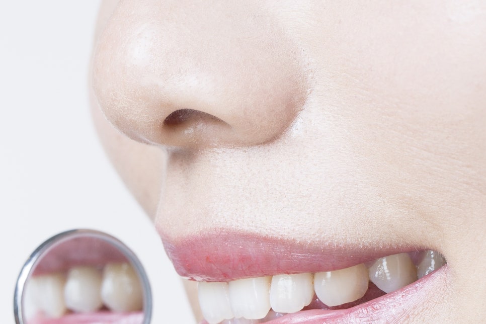 강남 20대임플란트 젊다고 방치는 금지 관련 이미지 22