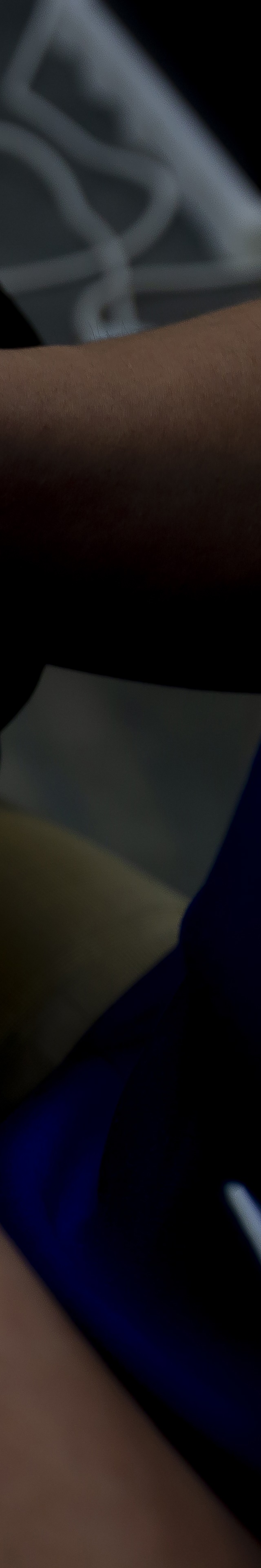 아랫니 라미네이트 숨겨왔던 미소를 되찾는 여정 관련 이미지 22