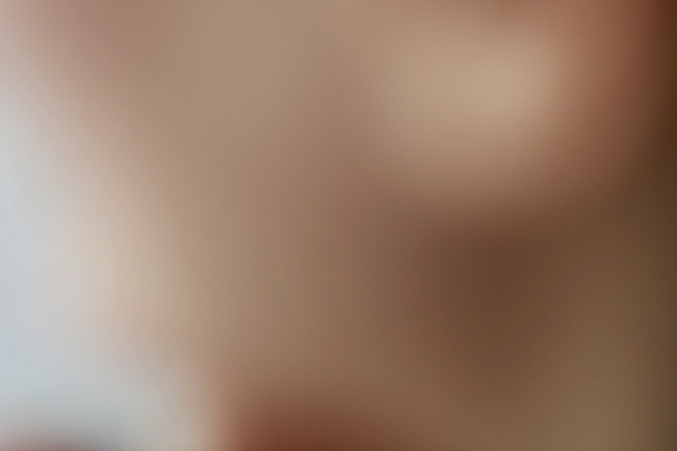 풀아치임플란트 비용 주의사항도 익혀보기 관련 이미지 26