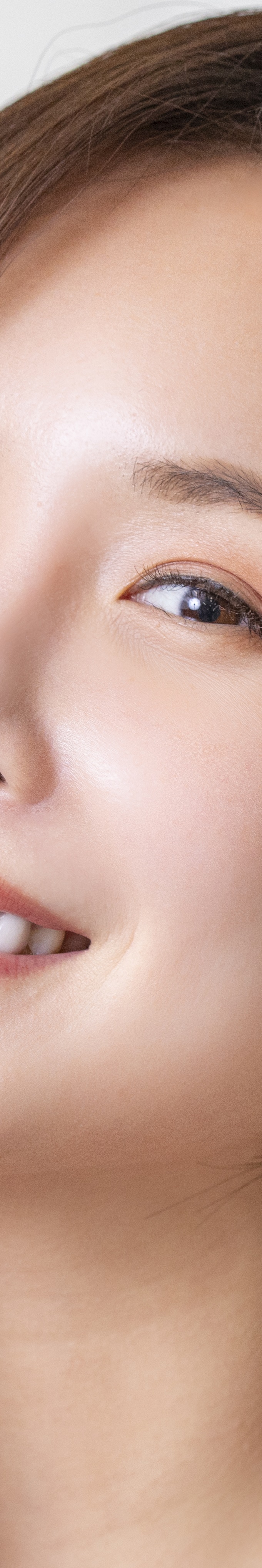 아랫니 라미네이트 숨겨왔던 미소를 되찾는 여정 관련 이미지 28