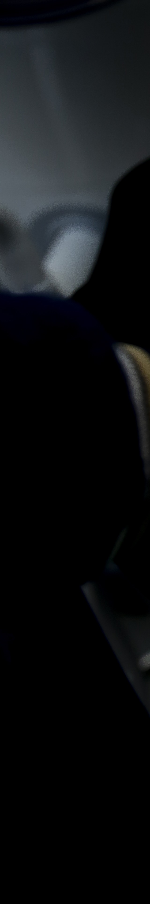 아랫니 라미네이트 숨겨왔던 미소를 되찾는 여정 관련 이미지 14