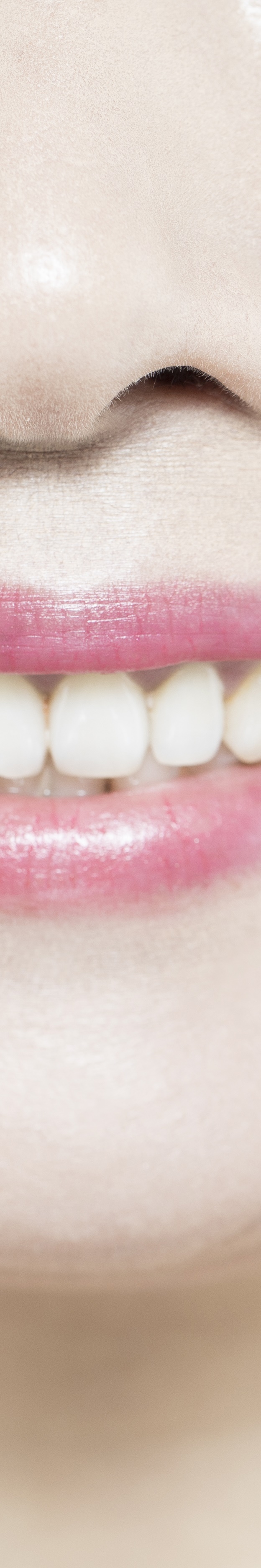 라미네이트 재시술 완벽한 미소를 위한 두 번째 여정 관련 이미지 27