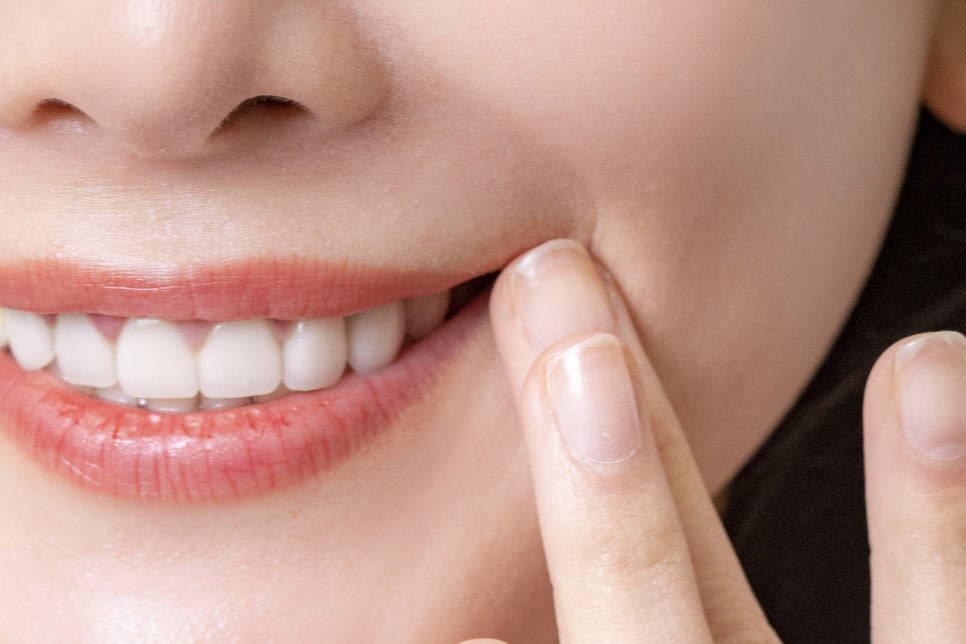 학동사거리치과 무치악 어르신들이라면? 관련 이미지 22