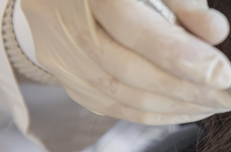 강남 20대임플란트 젊다고 방치는 금지 관련 이미지 12