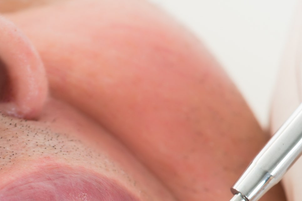 강남 노인임플란트 삶의 질이 달라져요 관련 이미지 10