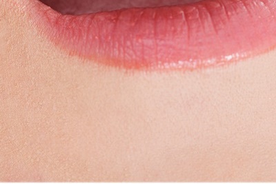 청담동치과 추천 앞니가 부러졌어요! 관련 이미지 17